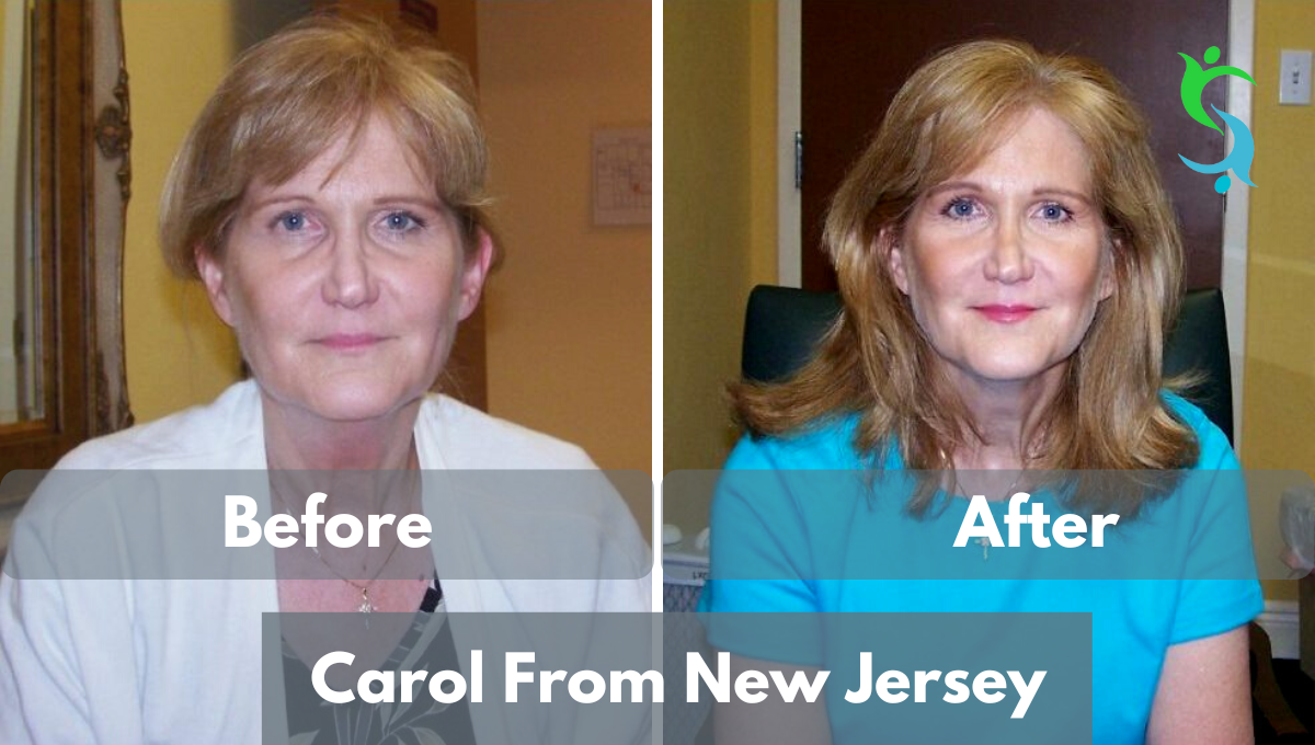 Carol from new jersey lyme disease treatment testimonial
