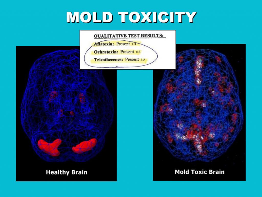 Mold toxins cause excess electrical activity in the brain